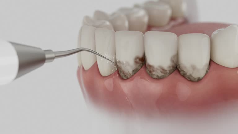 Trusted Wisdom Tooth Removal service in Sorrento, LA - Dentist Open Now